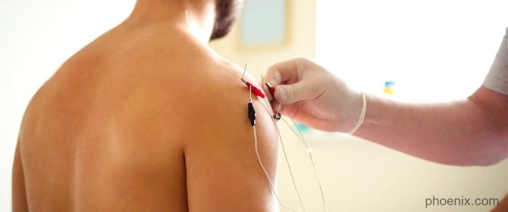 The 7 Best Acupuncture Clinics in Phoenix