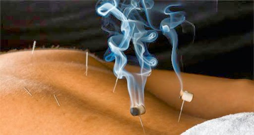 Blue Serenity Acupuncture